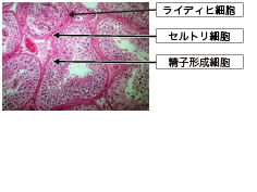 顕微鏡で拡大した、正常な精巣組織